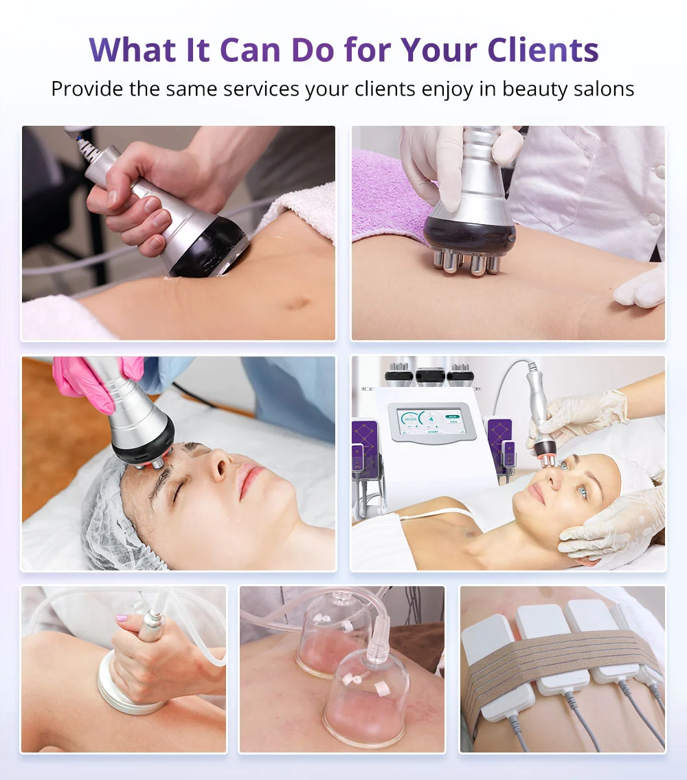 laser sculpt lipo treatment area